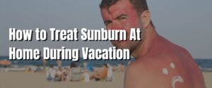 How to Treat Sunburn At Home During Vacation