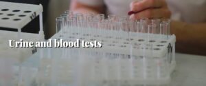 Urine and blood tests